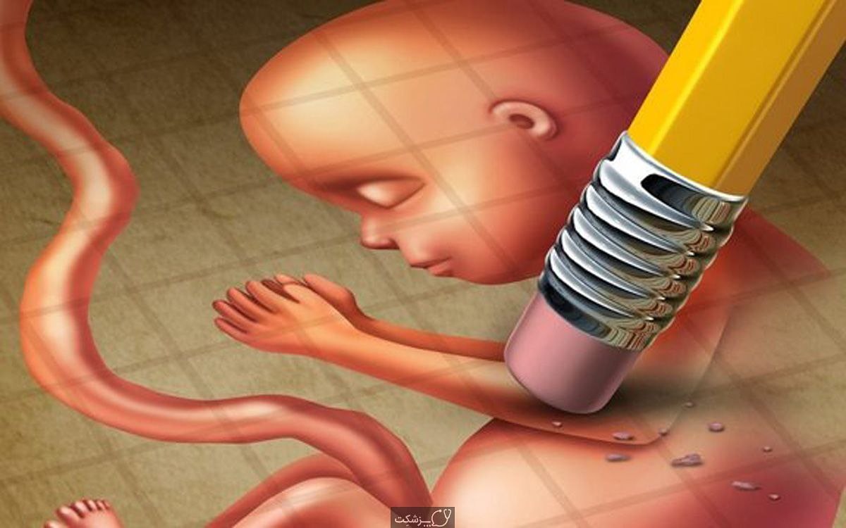 گزارش تکان‌دهنده روزنامه خراسان /سالی۳۰۰۰۰۰ فقط سقط غیر قانونی در ایران‌اسلامی