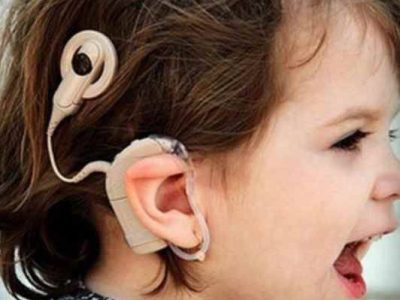 کشت رایگان حلزون شنوایی ‌برای کودکان