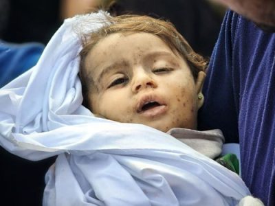 سازمان ملل: ۷۰ درصد شهدای غزه از زنان و کودکان هستند