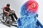 روند افزایشی بیماری ام اس در آذربایجان شرقی و کاهش سن ابتلا